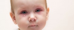 Conjuntivitis alérgica en niños - Oftalmología pediátrica en Venezuela